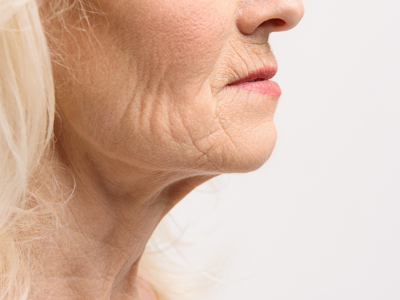 Plastic Surgeon Tells: "Doing This Every Morning Can Snap Back Loose Skin (DIY)"